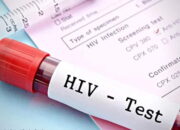 Skrining Darah di Mako Satpol PP Padang: 1 Waria dan Gay Positif HIV, 6 Orang Idap PML