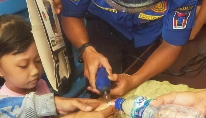 Kasihan Athira, Menahan Sakit di Jari Manisnya yang Membengkak Gegara Cincin