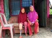 Impian 7 Tahun Susmayeni Miliki Kaki Palsu Terwujud Berkat UPZ Baznas Semen Padang