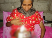 Resi Novalia, Menyamarkan Rasa Sakit dengan Senyuman