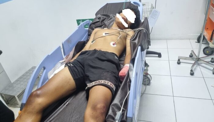 Tawuran Antar Geng di Padang Kian Gila, Tangan Kiri Pemuda Putus Tersabet Sajam