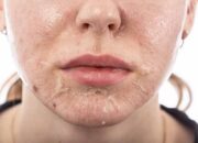 Dapatkan Kulit Sehat dengan Eksfoliasi dan Peeling Alami, Begini Caranya!