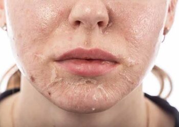 Dapatkan Kulit Sehat dengan Eksfoliasi dan Peeling Alami, Begini Caranya!