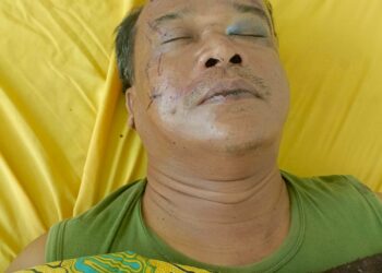 Korban Tertimpa Pohon Kayu di Sikabau Masih Belum Sadarkan Diri di RSUD Sei Dareh