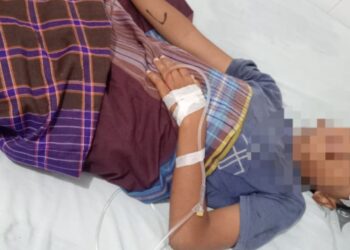 Bocah 10 Tahun di Kampung Dalam Tertembak Senapan Angin di Kepala Saat Bermain