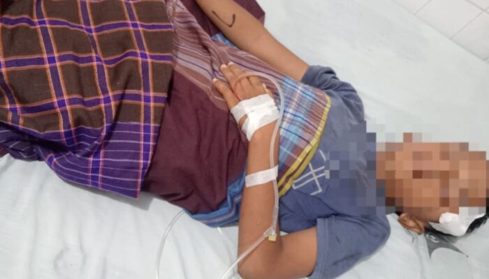 Bocah 10 Tahun di Kampung Dalam Tertembak Senapan Angin di Kepala Saat Bermain