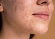 Cara Efektif Mengecilkan Pori-Pori Wajah