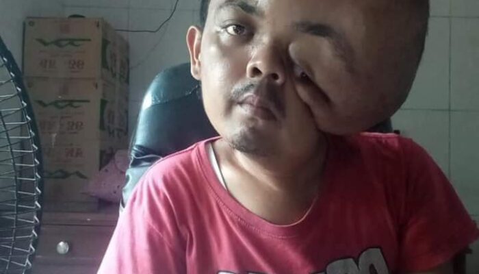 Dinsos Pessel Kunjungi Warga Penderita Tumor di Kampung Duku