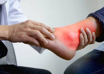 Makanan Rendah Purin untuk Diet Asam Urat