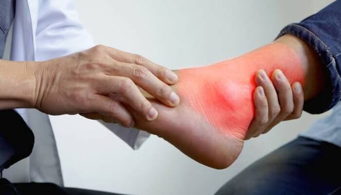 Makanan Rendah Purin untuk Diet Asam Urat