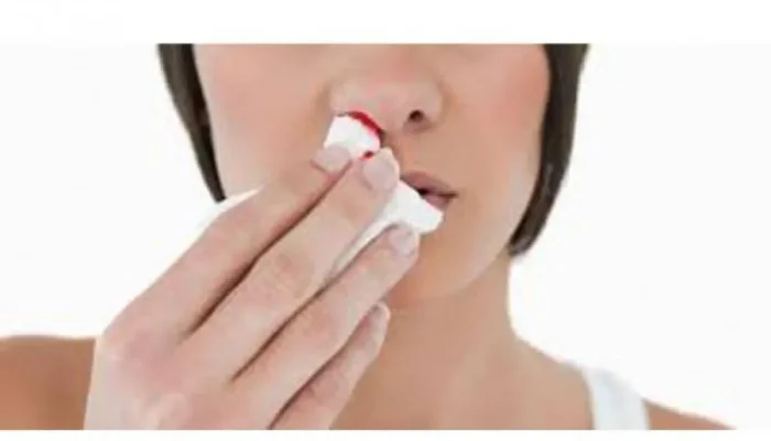 Tips Mencegah Mimisan