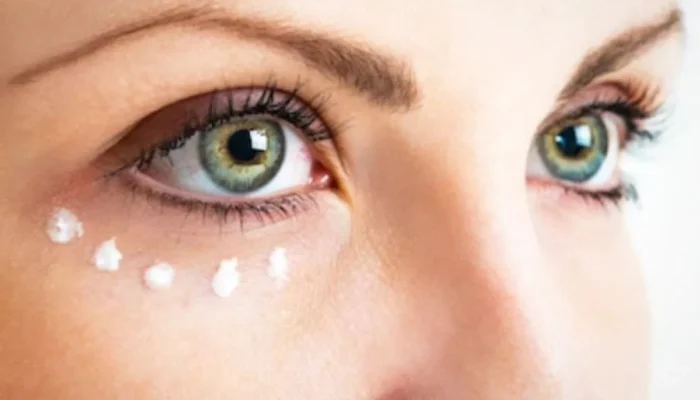 Kiat Cerdas Memilih Produk Krim untuk Lingkaran Hitam Mata