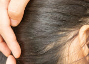 Tips Mengatasi Kutu Rambut Membandel