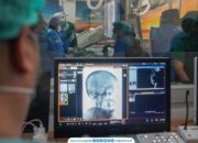 RS M. Djamil Hadirkan Teknologi Flow Diverter, Pasien Aneurisma Otak Kini Bisa Ditangani di Sumbar