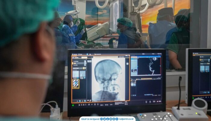 RS M. Djamil Hadirkan Teknologi Flow Diverter, Pasien Aneurisma Otak Kini Bisa Ditangani di Sumbar